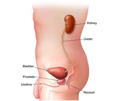 Ureteropelvic Junction Obstruction Ureteropelvic Junction Obstruction