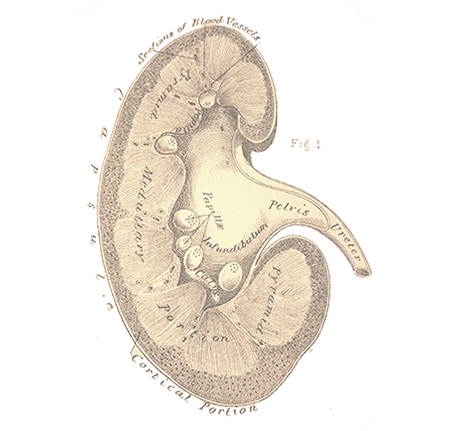Bladder Tumors