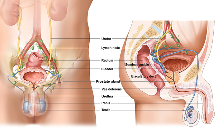 Prostate Cancer Prostate Cancer