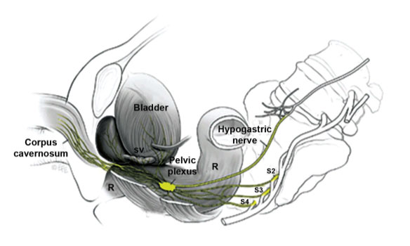 Damar sinir demetinin anatomik komşulukları. R:rektum, SV:seminal vesikül